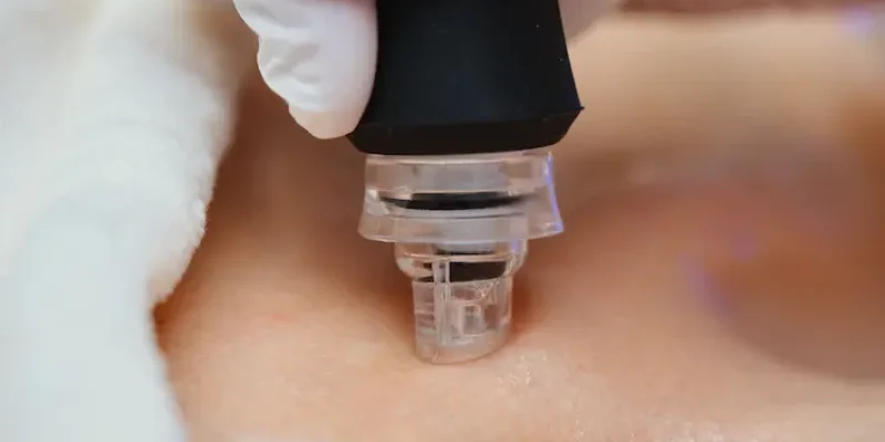 a-cosmetologist-performs-hydropiling-in-a-beauty-s-2025-03-05-15-14-48-utc